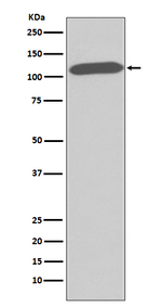 DPP4 Recombinant Rabbit Monoclonal Antibody (K01_3Q16)