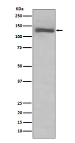 TLR7 Recombinant Rabbit Monoclonal Antibody (K01_3Q17)