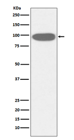 GRP94 Recombinant Rabbit Monoclonal Antibody (K01_3Q19)