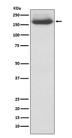 NF-M Recombinant Rabbit Monoclonal Antibody (K01_3Q21)