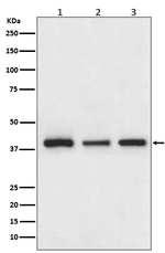 Cathepsin H/K/L/V Recombinant Rabbit Monoclonal Antibody (K01_3Q28)
