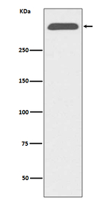 Apolipoprotein B Recombinant Rabbit Monoclonal Antibody (K01_3Q35)