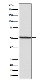 Phospho-IRF3 (Ser386) Recombinant Rabbit Monoclonal Antibody (K01_3Q45)