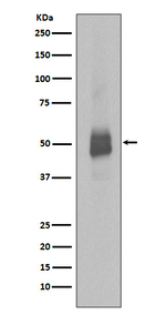 Phospho-Lyn (Tyr397) Recombinant Rabbit Monoclonal Antibody (K01_3Q46)