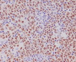 PAX5 Antibody in Immunohistochemistry (Paraffin) (IHC (P))