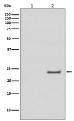 Phospho-RAC1/CDC42 (Ser71) Recombinant Rabbit Monoclonal Antibody (K01_3Q51)
