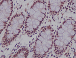 CDCA5 Antibody in Immunohistochemistry (Paraffin) (IHC (P))