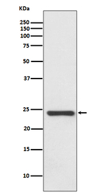 HSPB8 Recombinant Rabbit Monoclonal Antibody (K01_3Q56)
