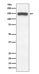 COL6A1/COL6A2/COL6A3 Antibody in Western Blot (WB)