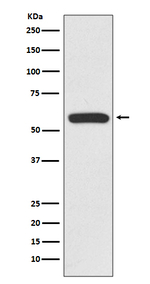 IRF6 Recombinant Rabbit Monoclonal Antibody (K01_3Q71)