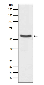 GLUT2 Antibody in Western Blot (WB)