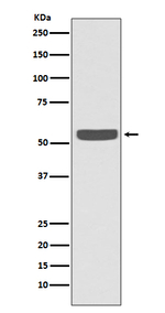 Cytokeratin 2e Antibody in Western Blot (WB)