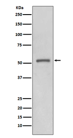 MMP11 Recombinant Rabbit Monoclonal Antibody (K01_3Q77)