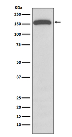 GLI1 Recombinant Rabbit Monoclonal Antibody (K01_3Q78)