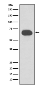 Cytokeratin 1 Antibody in Western Blot (WB)