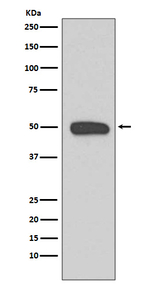 Cytokeratin 13 Antibody in Western Blot (WB)