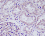 Adiponectin Receptor 1 Recombinant Rabbit Monoclonal Antibody (K01_3Q85)