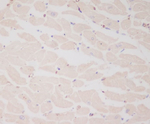 MYL2 Recombinant Rabbit Monoclonal Antibody (K01_3Q87)
