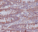 ABCF1 Antibody in Immunohistochemistry (Paraffin) (IHC (P))