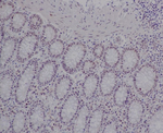 Ku80 Recombinant Rabbit Monoclonal Antibody (K01_3Q92)