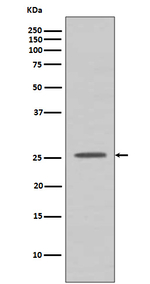BCL2A1 Recombinant Rabbit Monoclonal Antibody (K01_3Q99)