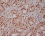 PI3K p85 Recombinant Rabbit Monoclonal Antibody (K01_3R04)