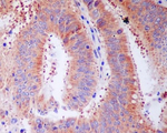 RPS3 Recombinant Rabbit Monoclonal Antibody (K01_3R05)