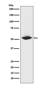 MMP1 Antibody in Western Blot (WB)