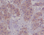 DAPK1 Antibody in Immunohistochemistry (Paraffin) (IHC (P))