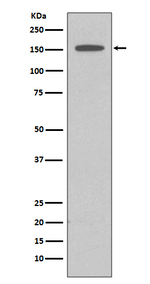 DAPK1 Antibody in Western Blot (WB)