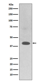 TRAM2 Recombinant Rabbit Monoclonal Antibody (K01_3R30)