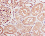 ID1 Antibody in Immunohistochemistry (Paraffin) (IHC (P))