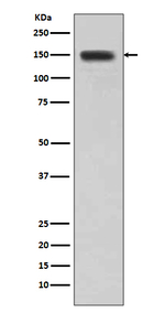 Desmoglein 1 Antibody in Western Blot (WB)
