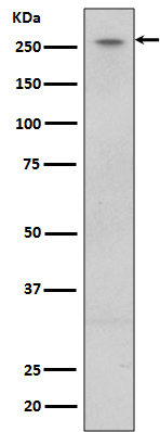 LRRK2 Antibody in Western Blot (WB)