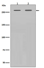 Filamin A Recombinant Rabbit Monoclonal Antibody (K01_3R70)
