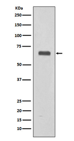 Complement C9 Antibody in Western Blot (WB)