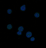 BCL6 Recombinant Rabbit Monoclonal Antibody (K01_3R74)
