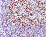 BCL6 Antibody in Immunohistochemistry (Paraffin) (IHC (P))