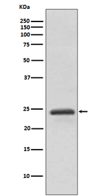 RAB11A Recombinant Rabbit Monoclonal Antibody (K01_3R90)