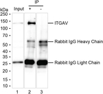 CD51 Antibody in Immunoprecipitation (IP)
