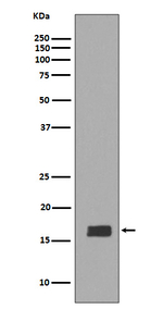 Synuclein alpha/beta Recombinant Rabbit Monoclonal Antibody (K01_3S02)