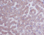Cytokeratin 8 Recombinant Rabbit Monoclonal Antibody (K01_3S06)
