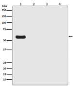 Firefly luciferase Antibody in Western Blot (WB)