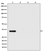 Renilla luciferase Antibody in Western Blot (WB)