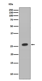 HOXB9 Recombinant Rabbit Monoclonal Antibody (K01_3S14)