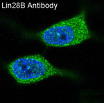 LIN28B Recombinant Rabbit Monoclonal Antibody (K01_3S17)