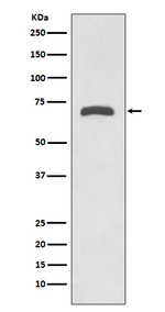 MMP8 Recombinant Rabbit Monoclonal Antibody (K01_3S21)
