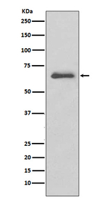 IRAK-M Recombinant Rabbit Monoclonal Antibody (K01_3S39)