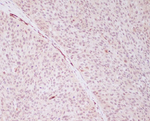 PRP19 Recombinant Rabbit Monoclonal Antibody (K01_3S42)