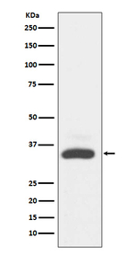 MAD2L1BP Antibody in Western Blot (WB)